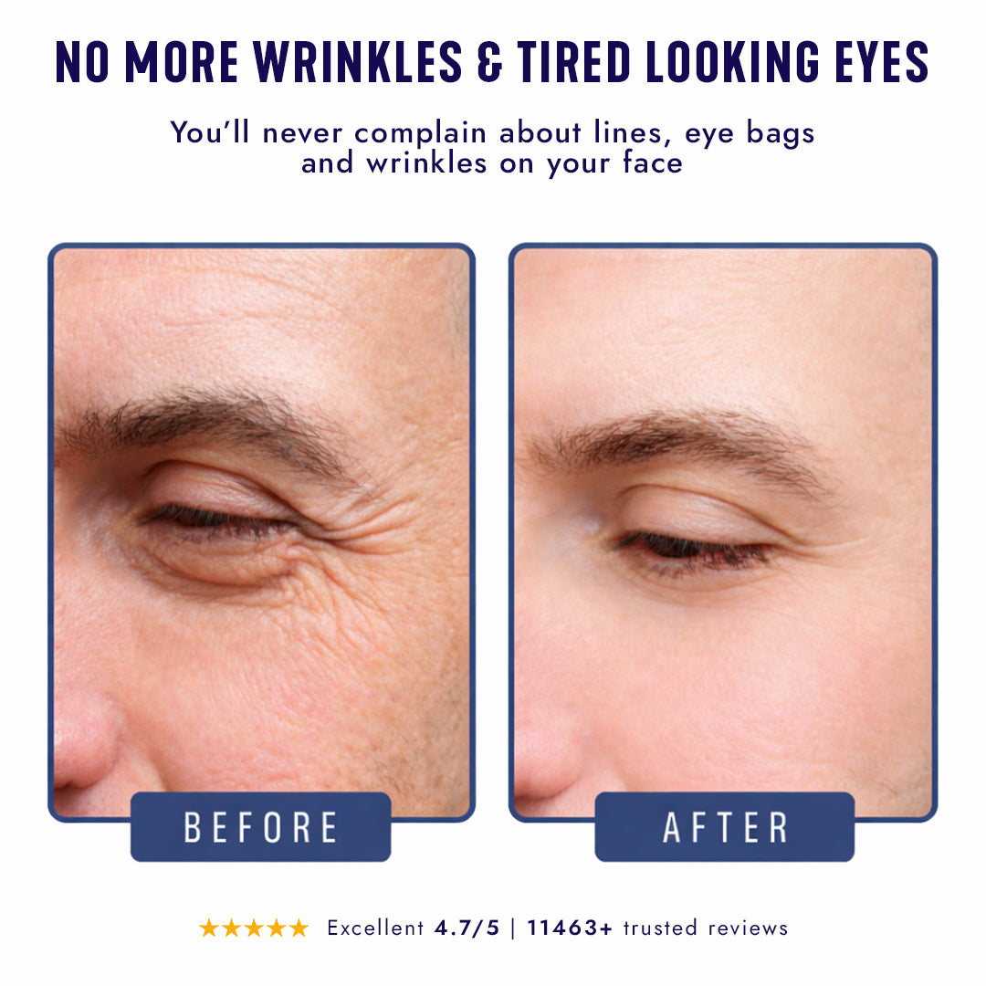 Under-Eye Repair Patches